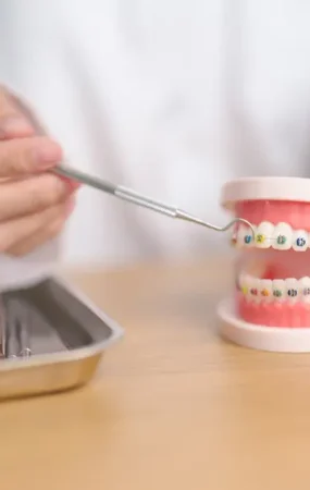 Braces Timeline How Long Does It Take to Get Braces Off